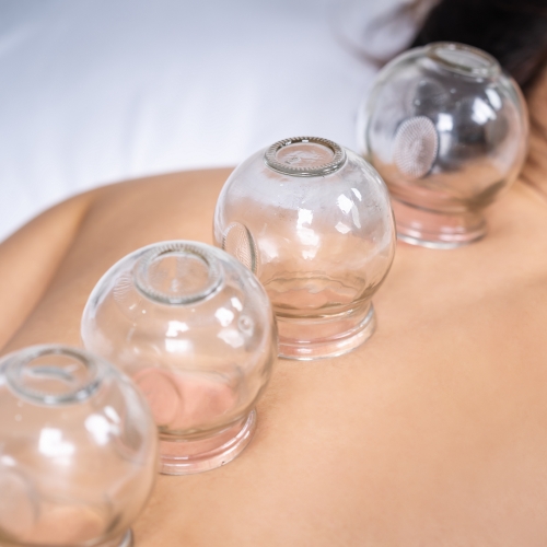 physical-therapy-clinic-cupping-prairie-rehabilitation-san-diego-sd-minnesota-mn