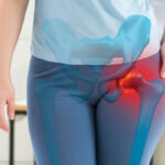 Hip Pain Affecting Your Daily Activities? Here’s What to Know